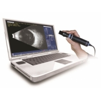 Máy siêu âm B B-scan Plus
